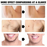 Painless Hair Removal Cream for Body Care-3