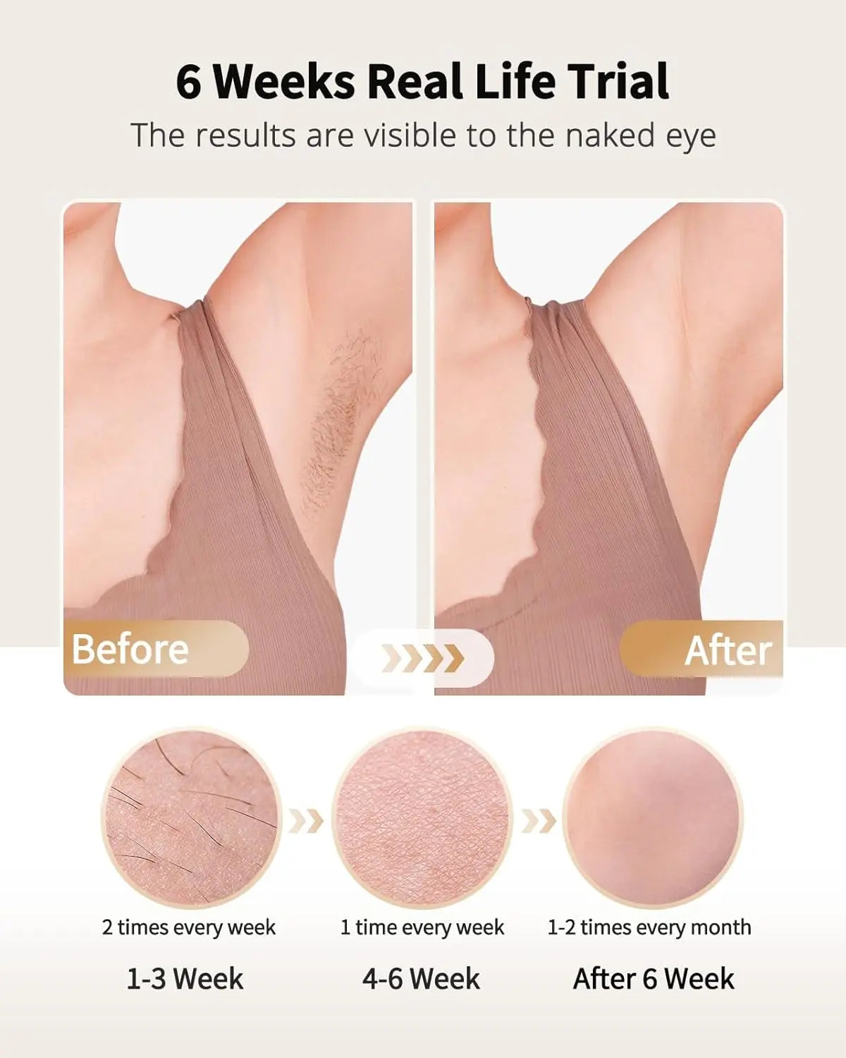 BeautyByOla – IPL Hair Removal Device, Unlimited Flash Ice-Cooling Laser, Painless Full Body Treatment for Women & Men