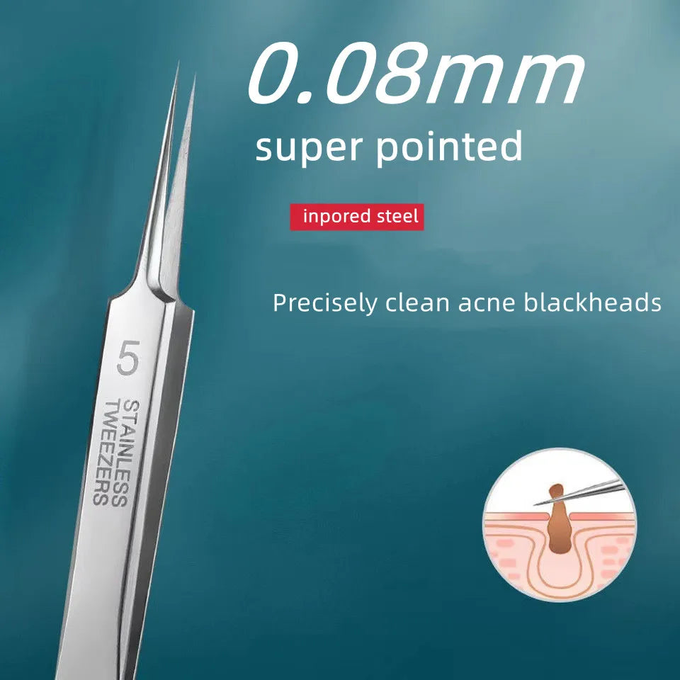 German No.5 Blackhead Remover Tweezers Ultra-Fine Acne Tool – BeautyByOla