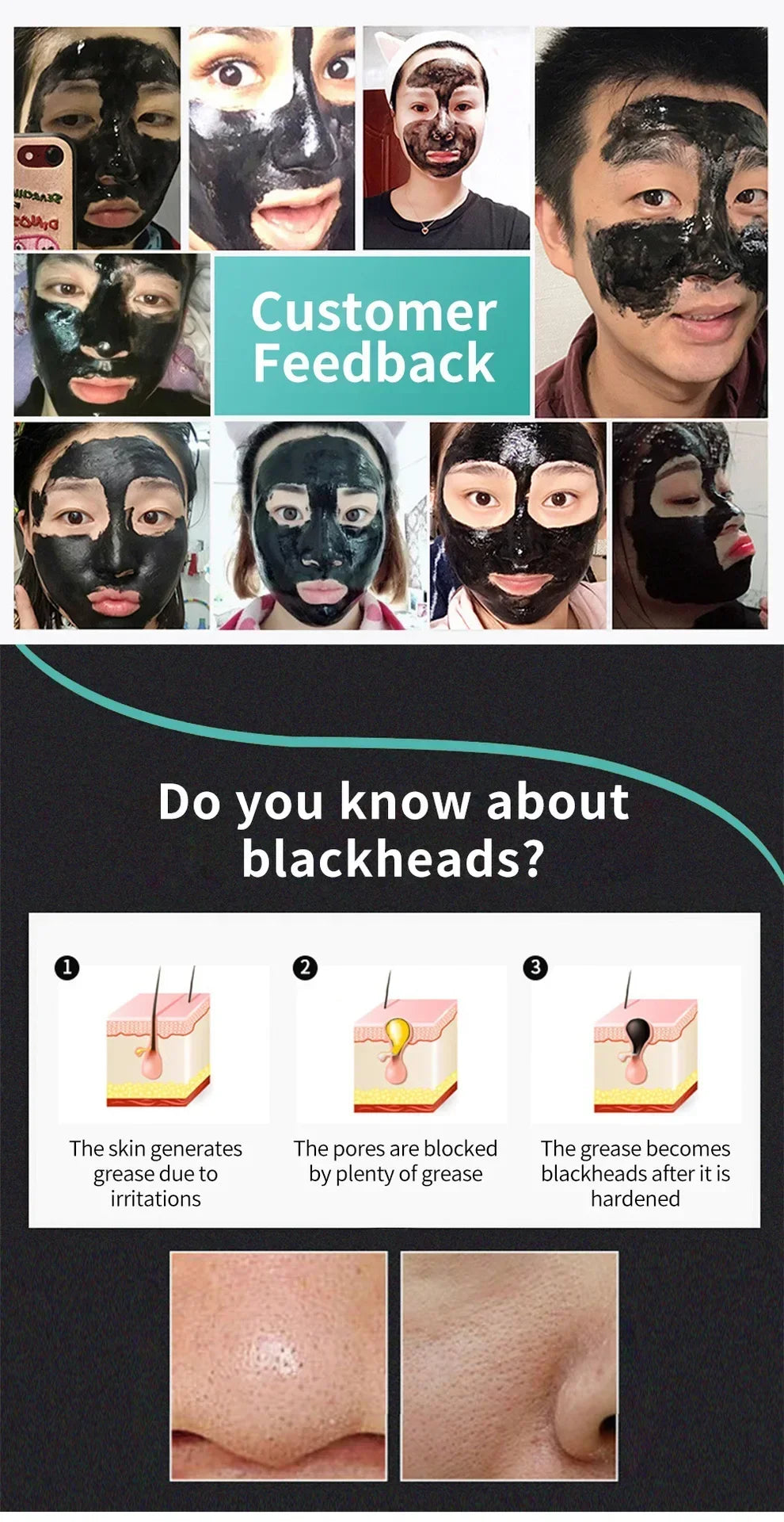 BeautyByOla – LANBENA Blackhead Removal Mask, Deep Cleansing & Pore Shrinking Treatment for Acne & Skin Brightening