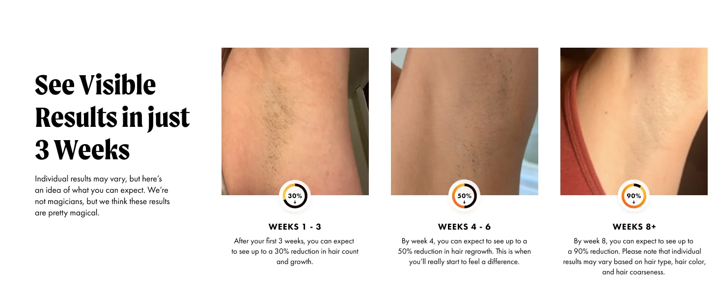BeautyByOla – IPL Hair Removal Device, Unlimited Flash Ice-Cooling Laser, Painless Full Body Treatment for Women & Men