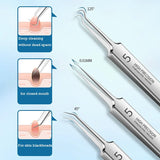 German No.5 Blackhead Remover Tweezers Ultra-Fine Acne Tool – BeautyByOla