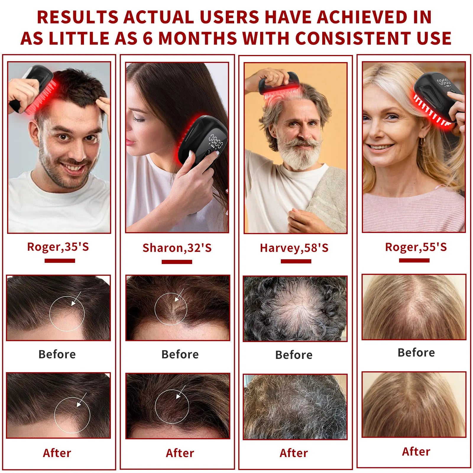 BeautyByOla – Wireless Hair Growth Device LLLT, 8PCS 660nm Diodes, Anti-Hair Loss Therapy Comb & Scalp Massager 1900mAh