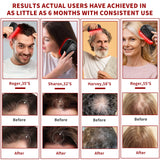 BeautyByOla – Wireless Hair Growth Device LLLT, 8PCS 660nm Diodes, Anti-Hair Loss Therapy Comb & Scalp Massager 1900mAh