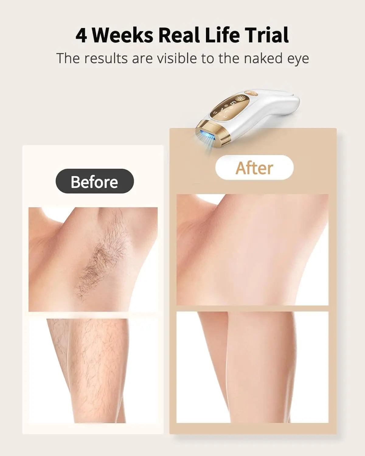 BeautyByOla – IPL Hair Removal Device, Unlimited Flash Ice-Cooling Laser, Painless Full Body Treatment for Women & Men
