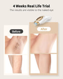 BeautyByOla – IPL Hair Removal Device, Unlimited Flash Ice-Cooling Laser, Painless Full Body Treatment for Women & Men