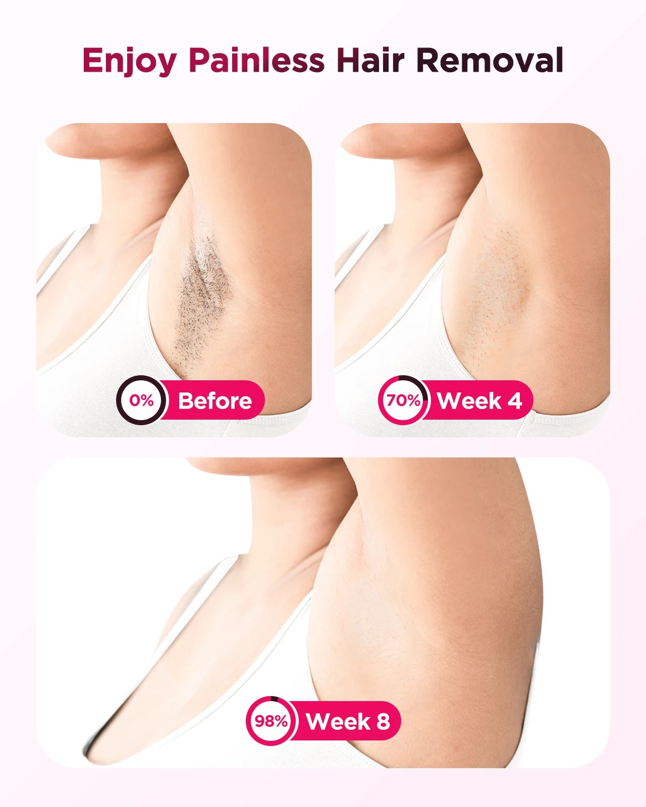 BeautyByOla – 990000 Flash IPL Laser Hair Removal, Painless Epilator for Men & Women, Body, Bikini & Facial