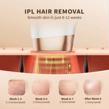 BeautyByOla – 3-in-1 IPL Hair Removal Device, Auto & Manual Modes, Full Body Painless Permanent Hair Removal
